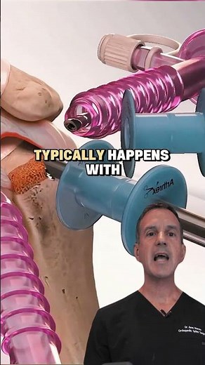 Rotator Cuff Repair is most effective shoulder surgery