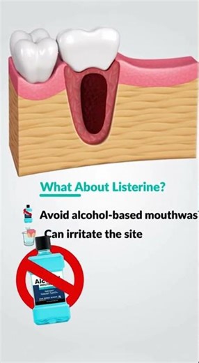 many patients want to rinse right away after a tooth extraction.