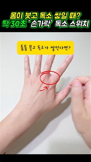 A 30-Second Acupressure Trick to Flush Out Body Swelling and Toxins 🚨 #HealthTips #ReduceSwelling