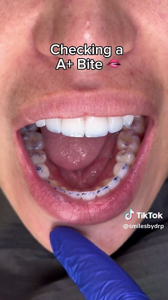 Checking the bite 🫦 notice how all of her teeth perfectly touch the bite paper 🙌 #asmr #dentalasmr #asmrmouthsounds #mouthsounds #asmrtapping #teethtok