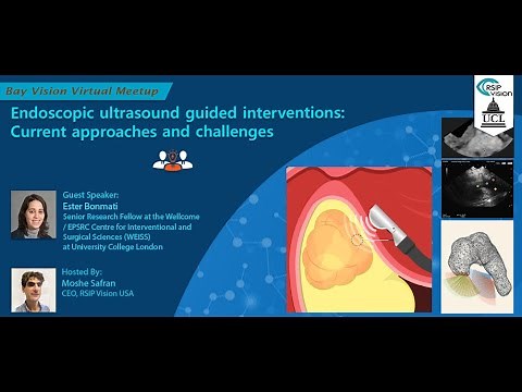 Endoscopic Ultrasound Guided Interventions: current approaches and challenges