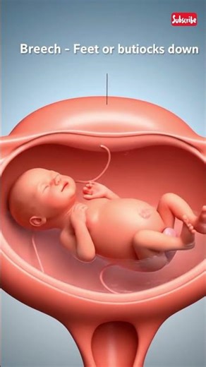 Fetal Position During Pregnancy: Cephalic, Breech & Transverse Explained by 3D Animation System