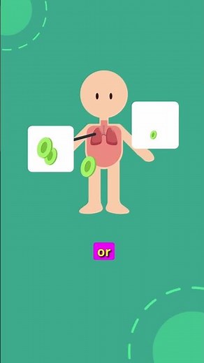 What Do Cancer Stages Really Mean?