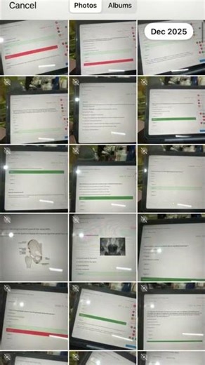 Cre exam | Norcet10 | Study smarter #youtubeshorts #youtubevideos #youtube #shortvideo #shorts