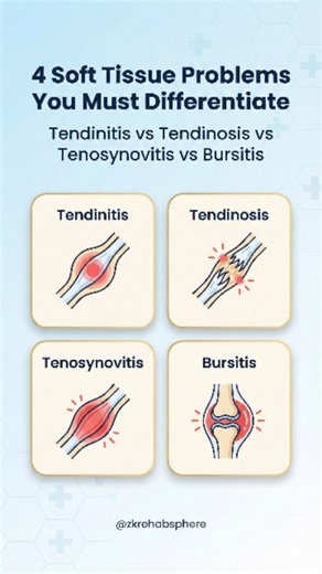 ZK Rehab Sphere on Instagram: "🦴 4 Soft Tissue Problems You MUST Differentiate! Tendinitis vs Tendinosis vs Tenosynovitis vs Bursitis These 4 terms confuse almost every medical & physio student — but the treatment is NOT the same ⚠️ 🟥 TENDINITIS → Acute tendon inflammation • Pain with movement • Tenderness & swelling • Improves with rest & anti-inflammatory care 🟧 TENDINOSIS → Chronic tendon degeneration (NOT inflammation) • Long-standing overuse pain • Poor healing response • Needs loading-b