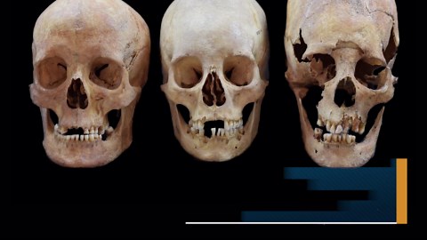 Foreign Eggheads: Pointy-Skulled Women Were Immigrant Brides