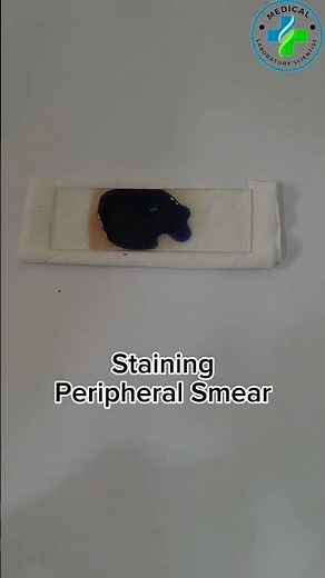 Blood smear and Giemsa staining | Staining | Hematology | how to do Giemsa stain in hematology