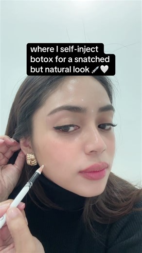 Aesthetic Doctor's Self-Injecting Tips for Natural Look