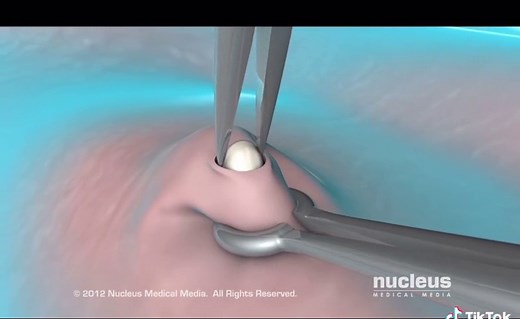 Dr. Lamia Gabal on TikTok