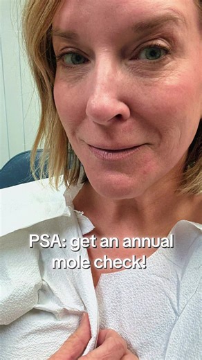 Have you had your annual mole check yet? DO IT. And wear underwear (pro tip). Here’s to hoping the biopsy is clear! 👍🏼#dermatology #skincancer