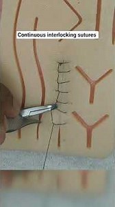 learn suturing: CONTINUOUS INTERLOCKING SUTURES #surgicalskills #surgeon #suturing