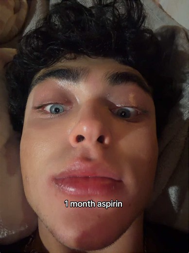 1 Month Aspirin for Lighter Eyes: Does Megadose Aspirin Work?