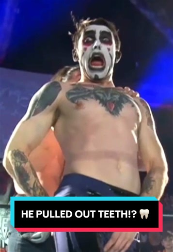 He pulled out teeth!? #wrestlingrevolver #danhausen #funny | wrestlers