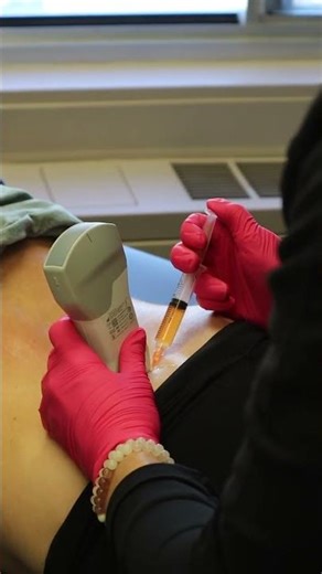 Ultrasound-Guided PRP Into the Spine?! Caroline Makes It Look EASY 😳💉