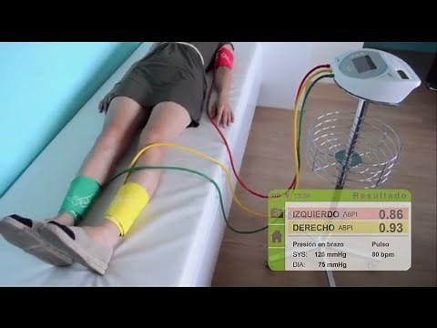 Indice Tobillo-Brazo con MESI ABPI MD