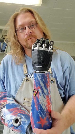 Custom Prosthetic Arm Above Elbow | Silicone Liner Price