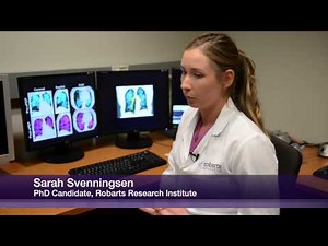 Western researchers find that a new COPD therapy device makes breathing easier