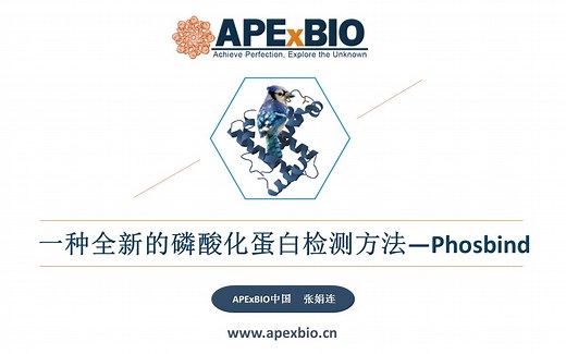一种全新的磷酸化蛋白检测方法——Phosbind