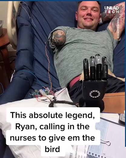 10M views · 50K reactions | This engineer has been using TikTok to share his progression for creating a fully-functioning bionic hand 料 | UNILAD Tech | Facebook