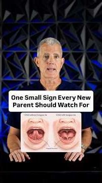 How to tell if your baby has a tongue tie
