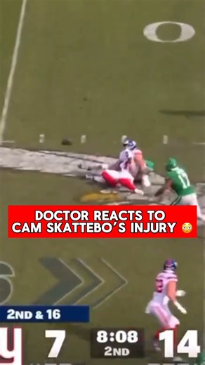 370K views · 2K reactions | 喙 Dr Dan reacts to Cam Skattebo’s brutal ankle injury breaking down exactly what happens when a player’s foot dislocates and why “reducing it” fast on the field can make or break recovery. #CamSkattebo #DoctorReacts #NFLInjury #GiantsNation #SportsPodcast #SportsMedicine #BubbaArmy #FootballTalk #InjuryBreakdown #RookieSeason #NFL #SportsNews | Bubba the Love Sponge® Show | Facebook