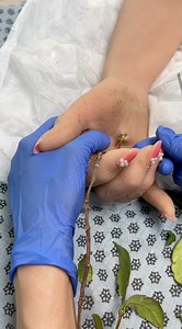 Doctor quickly cures injury | The Anna Show