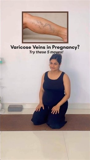 Prevent Varicose Veins in Pregnancy | Simple Exercises for daily practice