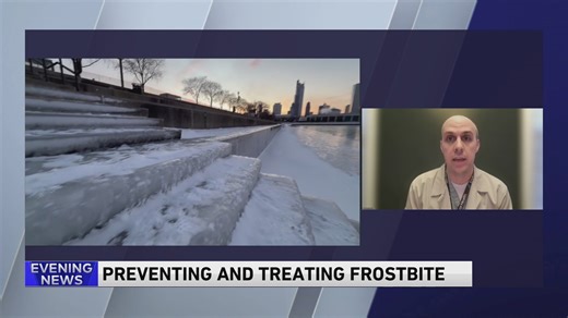 Prevent frostbite: Essential steps to protect skin in extreme cold