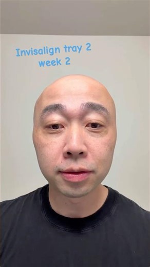 Invisalign tray 2 week 2. Sept 30, 2025