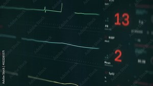 Medical electronic device shows the pulse graph. Electronic pulse monitoring graph slowly rises from a flatline. Electronic system displaying the pulse graph identifying the resurrection of a patient.