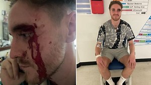 Gay couple viciously attacked by armed gang