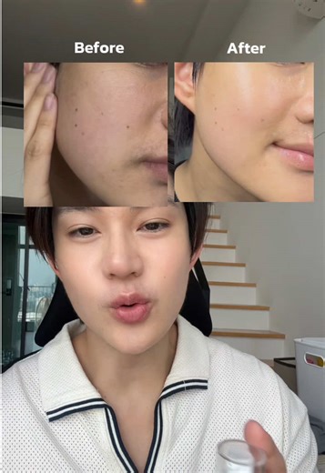 เป็นเซรั่มที่ช่วงนี้ผมใช้บ่อยมากกก #glad2glow #เซรั่มทับทิมผิวโกลว์ #สกินแคร์