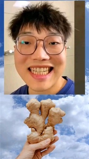 Achieve a Brighter Smile with These Teeth Whitening Tips! 🌟 "Unlock the secret to a radiant smile with our top teeth whitening tips! 😁✨ In this video, we’ll share natural and effective methods to whiten your teeth at home. From easy DIY remedies to essential dental hygiene practices, discover how to maintain a bright, healthy smile. Say goodbye to stains and hello to confidence! 🌿🦷 Don’t forget to like, comment, and share your results! #TeethWhitening #SmileBright #DentalCare #BeautyTips" | 