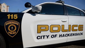 Two injured, one seriously, when they are struck by a car in Hackensack