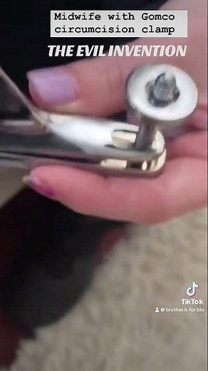 Midwife with Gomco clamp