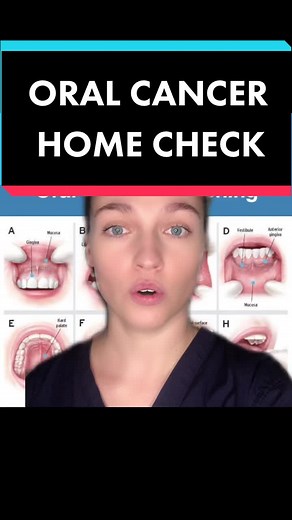Oral Cancer Awareness: Home Check and Symptoms