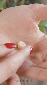 269K views · 433 reactions | First aid summer hacks 洛 | 5-Minute Crafts | Facebook