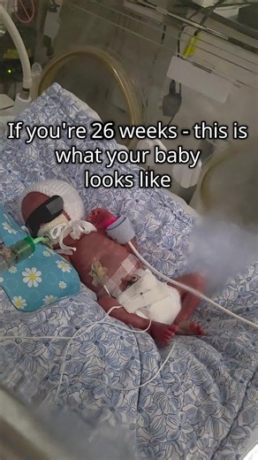 What to Expect When Your Baby is 26 Weeks Old