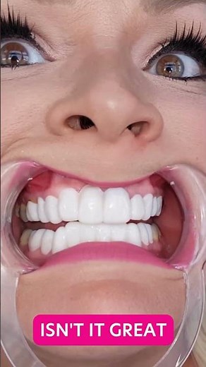 Instasmile clip in veneers! Perfect teeth in seconds.