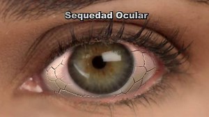 Optical 20/20 TV Spot, 'Sequedad Ocular'
