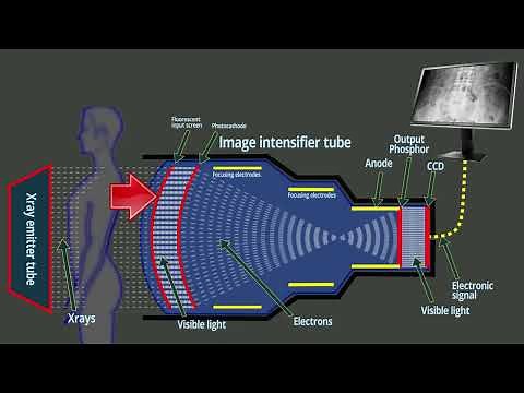 Fluoroscopy : Xray intensifier tube - Basic functions