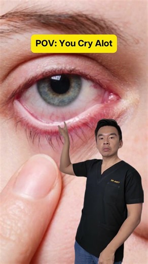 Crying Too Much? Here’s What Happens to Your Eyes