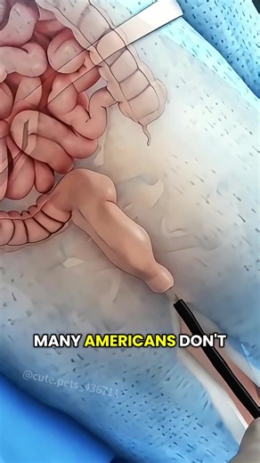 Colonoscopy Procedure!!(3D Animation)#colonoscopy #colonoscopyprep #colonoscopyday #medical3danimation #3dmedicalanimation #colonoscope #colonpolyp #coloncancer #fyp