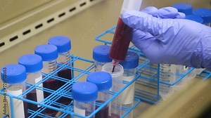 Transferring Whole Blood to a Conical Centrifuge Tube Under a Steril Hood in a Lab - PRP and Stem Cell Process - Close Up