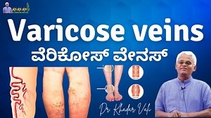 63K views · 2.1K reactions | Varicose Veins - ವೆರಿಕೋಸ್ ವೇನಸ್ - Dr. Khadar Vali #varicoseveins #vericoseveintreatment #khadarvali | Dr. Khadar Vali Fans Club | Facebook