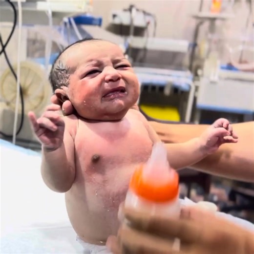 Today we welcomed a tiny, cute, and absolutely adorable baby in our NICU. 💕 Watch how our dedicated NICU team provides gentle care, love, and attention to this little fighter. Every baby is special, and this video highlights the beauty, strength, and innocence of newborns receiving neonatal care. 🌸👶 If you love babies and want to learn more about NICU life, newborn care, and parenting tips, don’t forget to like, #feeding #fblifestyle #fbreelsfypシ゚viralシ #fblifestyletyle #fblifestylechallenge 