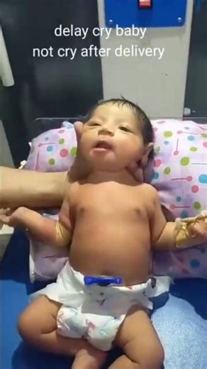 Intellectual disability #intellectualdisability #mr #psychology