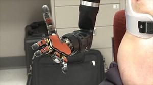 Tomorrow Daily 103: Man's bionic arms make history, NASA proposes cloud cities on Venus and more