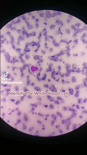 identify the White blood cells #microscope #medtech #laboratory #medtechstudent #rmt #blood