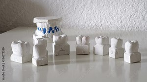 Dentist hand put prosthesis of teeth models made on automatic process dental milling machine